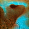 Meddle